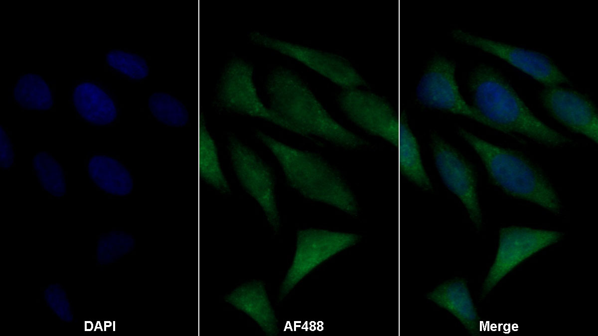 Polyclonal Antibody to 4-Hydroxyphenylpyruvate Dioxygenase (HPD)