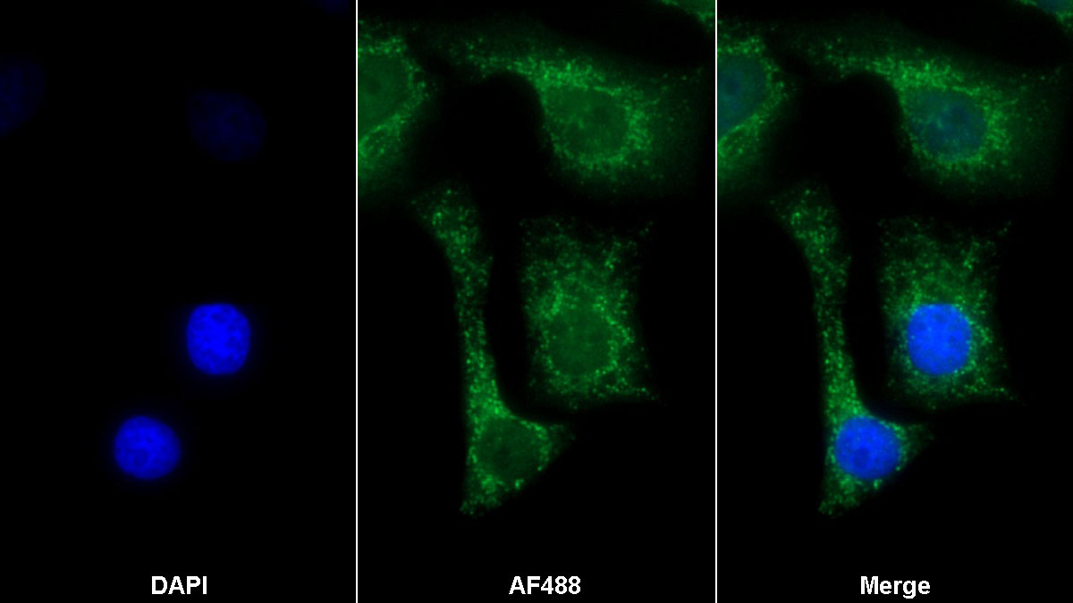 Polyclonal Antibody to Prolyl-4-Hydroxylase Alpha Polypeptide II (P4Ha2)