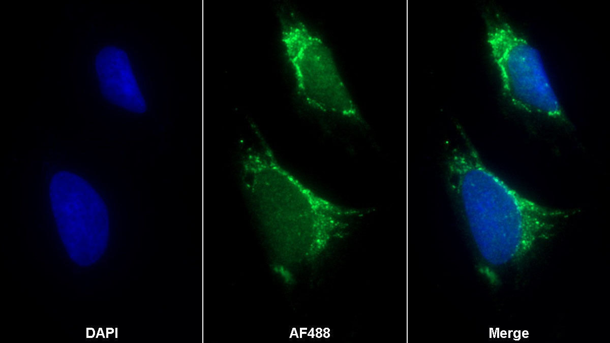 Polyclonal Antibody to Prolyl-4-Hydroxylase Alpha Polypeptide II (P4Ha2)