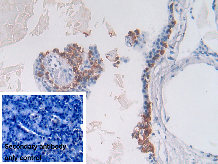 Polyclonal Antibody to Prolyl-4-Hydroxylase Alpha Polypeptide II (P4Ha2)