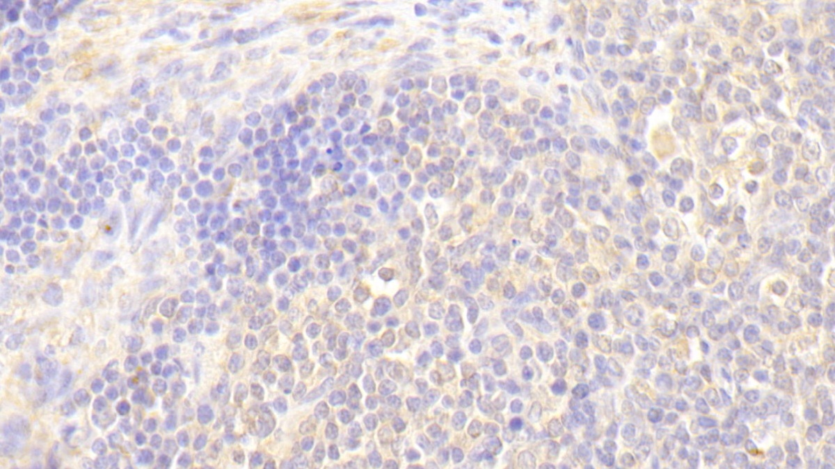 Polyclonal Antibody to B-Lymphoid Tyrosine Kinase (BLK)