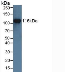 Polyclonal Antibody to Muscle, Skeletal, Receptor Tyrosine Kinase (MUSK)