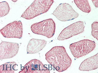 Polyclonal Antibody to C-Mer Proto Oncogene Tyrosine Kinase (MERTK)