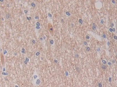 Polyclonal Antibody to C-Ros Oncogene 1, Receptor Tyrosine Kinase (ROS1)