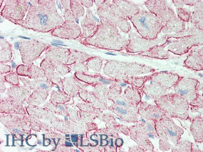 Polyclonal Antibody to C-Ros Oncogene 1, Receptor Tyrosine Kinase (ROS1)