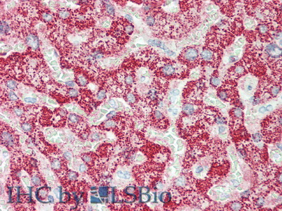 Polyclonal Antibody to C-Ros Oncogene 1, Receptor Tyrosine Kinase (ROS1)