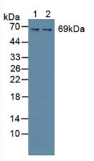 Polyclonal Antibody to Spleen Tyrosine Kinase (SYK)