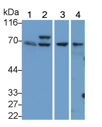 Polyclonal Antibody to Spleen Tyrosine Kinase (SYK)