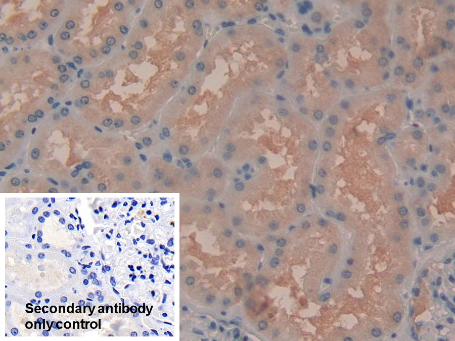 Polyclonal Antibody to Spleen Tyrosine Kinase (SYK)