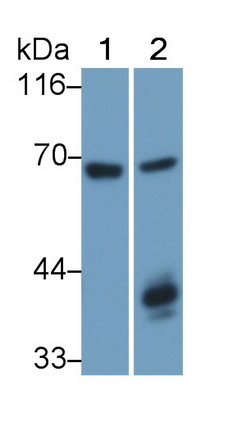 Polyclonal Antibody to Spleen Tyrosine Kinase (SYK)