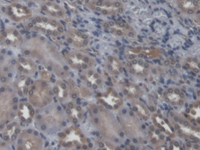 Polyclonal Antibody to Sialidase 2, Cytosolic (SIAL2)