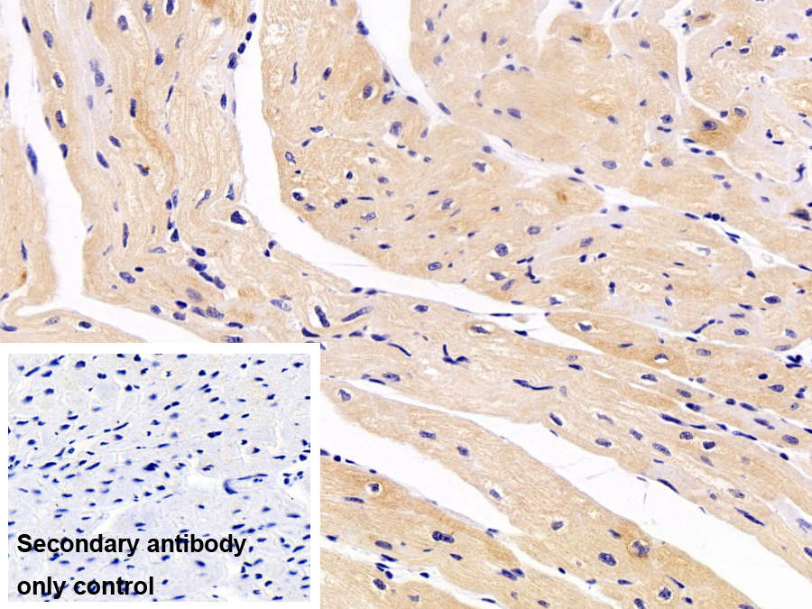 Polyclonal Antibody to Synaptic Ras GTPase Activating Protein 1 (SYNGAP1)