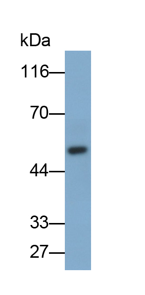 Polyclonal Antibody to Chimerin 1 (CHN1)