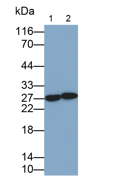 Polyclonal Antibody to Rho GDP Dissociation Inhibitor Beta (ARHGDIb)