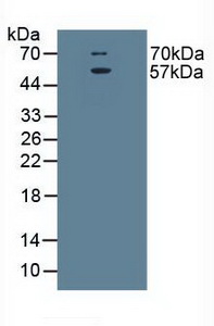 Polyclonal Antibody to Excitatory Amino Acid Transporter 3 (EAAT3)