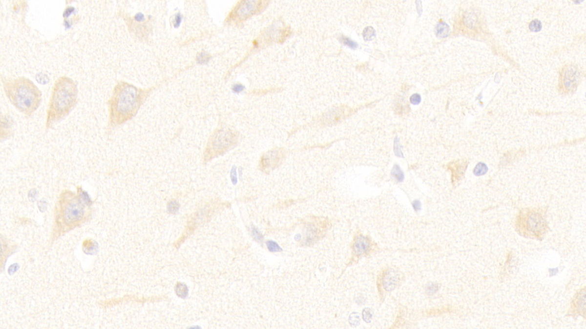 Polyclonal Antibody to Excitatory Amino Acid Transporter 3 (EAAT3)