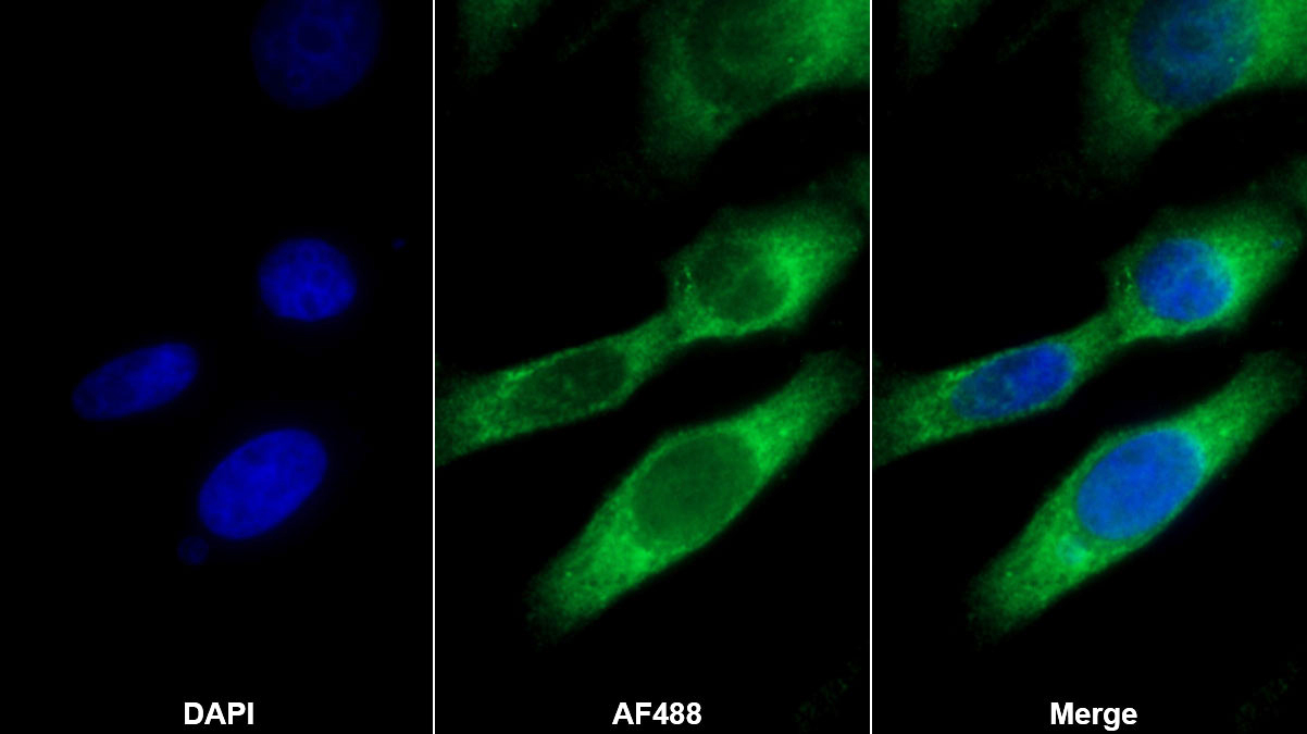 Polyclonal Antibody to Solute Carrier Family 3, Member 2 (SLC3A2)