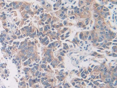 Polyclonal Antibody to Na-Cl Cotransporter (NCCT)