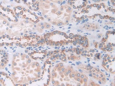 Polyclonal Antibody to Na-Cl Cotransporter (NCCT)