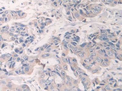 Polyclonal Antibody to Na-Cl Cotransporter (NCCT)