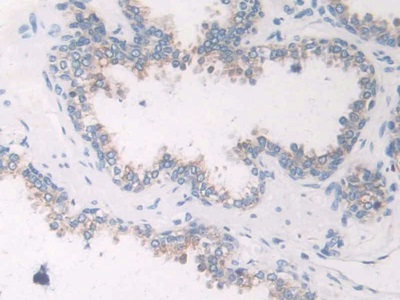 Polyclonal Antibody to Na-Cl Cotransporter (NCCT)