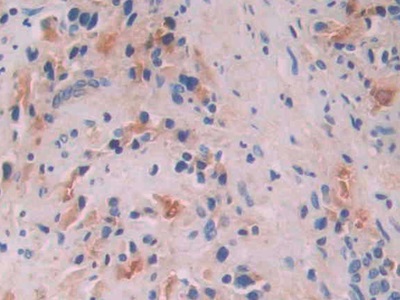 Polyclonal Antibody to Anion/Sugar Transporter (AST)