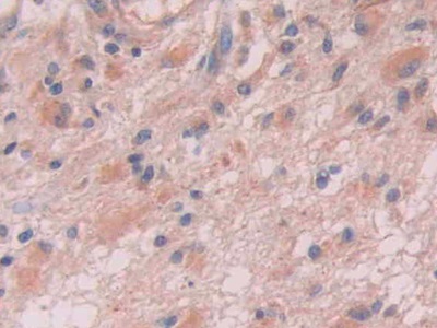 Polyclonal Antibody to Anion/Sugar Transporter (AST)