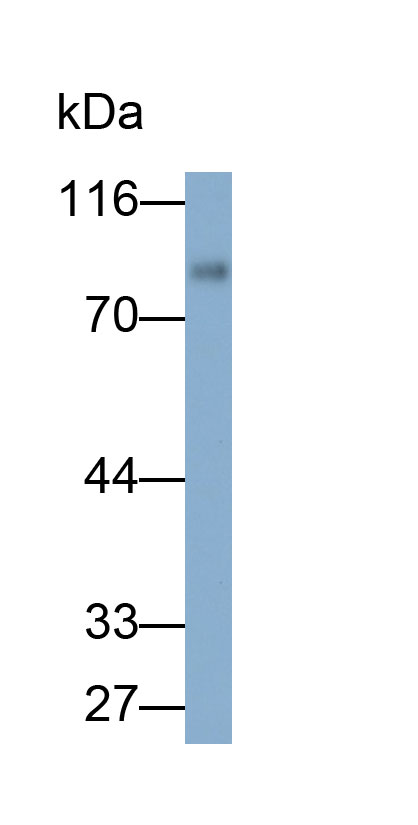 Polyclonal Antibody to Gibbon Ape Leukemia Virus Receptor 1 (GLVR1)