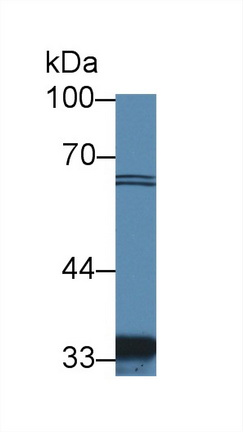 Polyclonal Antibody to Solute Carrier Family 30 Member 8 (SLC30A8)