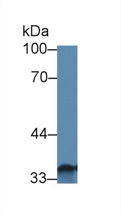 Polyclonal Antibody to Solute Carrier Family 30 Member 8 (SLC30A8)