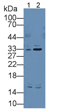 Polyclonal Antibody to Electron Transfer Flavoprotein Alpha Polypeptide (ETFa)