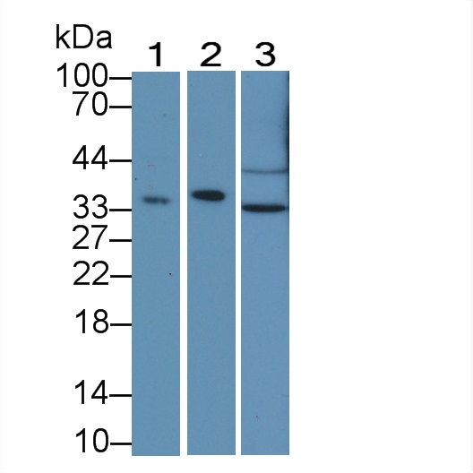 Polyclonal Antibody to Electron Transfer Flavoprotein Alpha Polypeptide (ETFa)