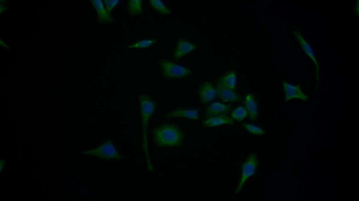 Polyclonal Antibody to Electron Transfer Flavoprotein Alpha Polypeptide (ETFa)