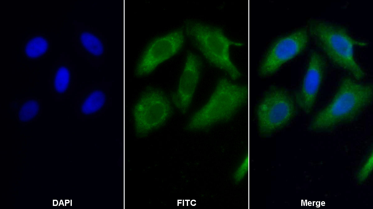 Polyclonal Antibody to Electron Transfer Flavoprotein Alpha Polypeptide (ETFa)