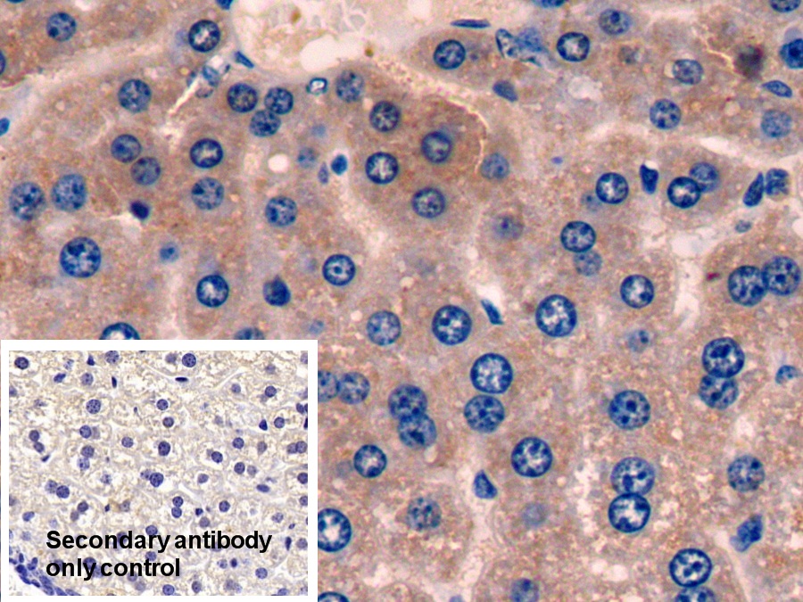 Polyclonal Antibody to Electron Transfer Flavoprotein Alpha Polypeptide (ETFa)