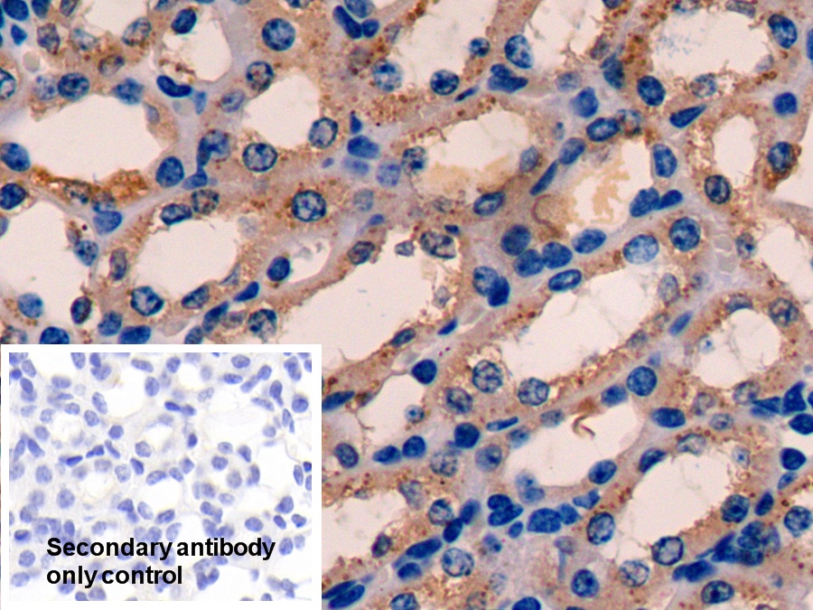 Polyclonal Antibody to Electron Transfer Flavoprotein Alpha Polypeptide (ETFa)