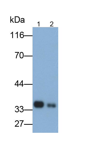 Polyclonal Antibody to Electron Transfer Flavoprotein Alpha Polypeptide (ETFa)