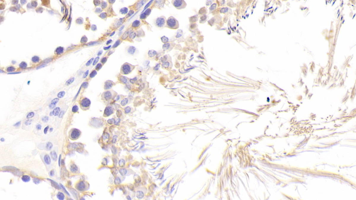 Polyclonal Antibody to WAP Four Disulfide Core Domain Protein 5 (WFDC5)