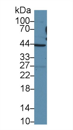 Polyclonal Antibody to Tafazzin (TAZ)