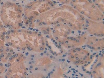 Polyclonal Antibody to Tafazzin (TAZ)