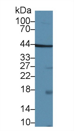 Polyclonal Antibody to Tafazzin (TAZ)