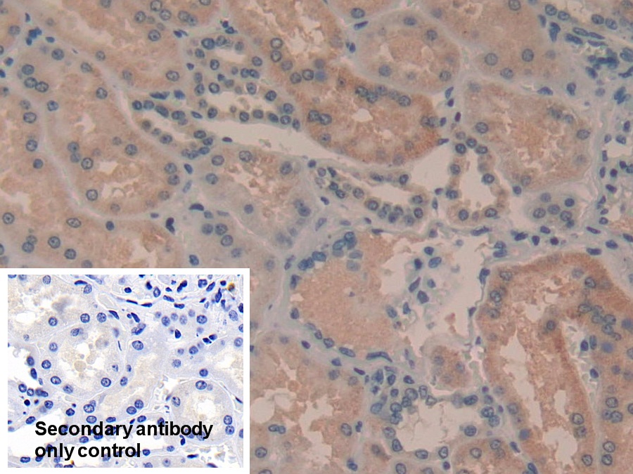 Polyclonal Antibody to Tafazzin (TAZ)