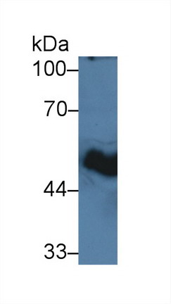 Polyclonal Antibody to Glycoprotein 2, Zymogen Granule Membrane (GP2)