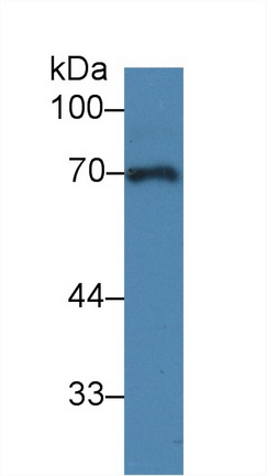 Polyclonal Antibody to Alpha-1-B-Glycoprotein (a1BG)