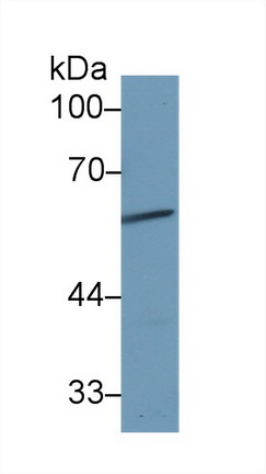 Polyclonal Antibody to Alpha-1-B-Glycoprotein (a1BG)