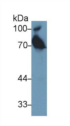 Polyclonal Antibody to Alpha-1-B-Glycoprotein (a1BG)