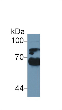 Polyclonal Antibody to Alpha-1-B-Glycoprotein (a1BG)