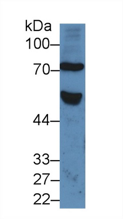 Polyclonal Antibody to Frizzled Homolog 1 (FZD1)