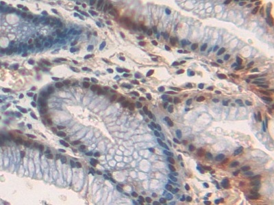 Polyclonal Antibody to Frizzled Homolog 1 (FZD1)