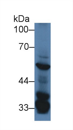 Polyclonal Antibody to Serum/Glucocorticoid Regulated Kinase 3 (SGK3)